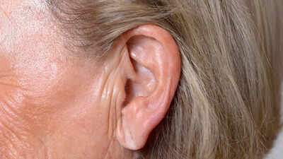 Can earlobe crease predict heart attack, diabetes and stroke risk: Myths vs facts |