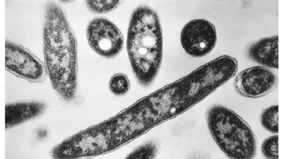 California plague case: Lake Tahoe resident bitten by infected flea, contracts plague; patient under medical supervision | World News