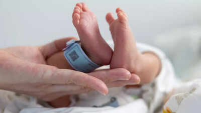 Rarest of rare: ‘Foetus-in-foetus’ baby delivered at Karnataka hospital | Hubballi News