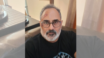 ‘Pain as a consequence’: BJP Kerala chief Rajeev Chandrasekhar injured in treadmill fall, shares lesson | India News