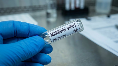Saudi citizens warned as deadly Marburg Virus outbreak hits Southern Ethiopia | World News