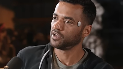 Deepinder Goyal Temple Device: AIIMS doctor questions the scientific basis of Deepinder Goyal’s temple device, cites lack of clinical proof |