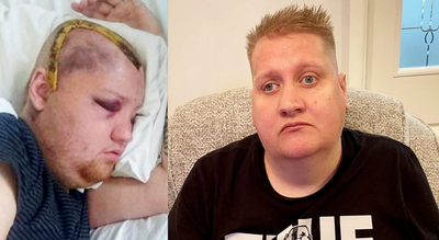 ‘It’s a nightmare’: UK man sues NHS after receiving eight years of chemotherapy instead of six months |