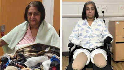 Indian-origin woman in England loses all four limbs after dog lick leads to sepsis: ‘How did this happen in 24 hours?’