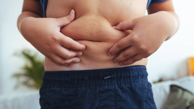 A swollen belly mistaken for weight gain: Doctor explains how neuroblastoma, a common cancer in children, often hides in plain sight