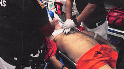 ‘Likely caused by strangulation’: Doctor who observed Jeffrey Epstein autopsy makes shock claim about his death